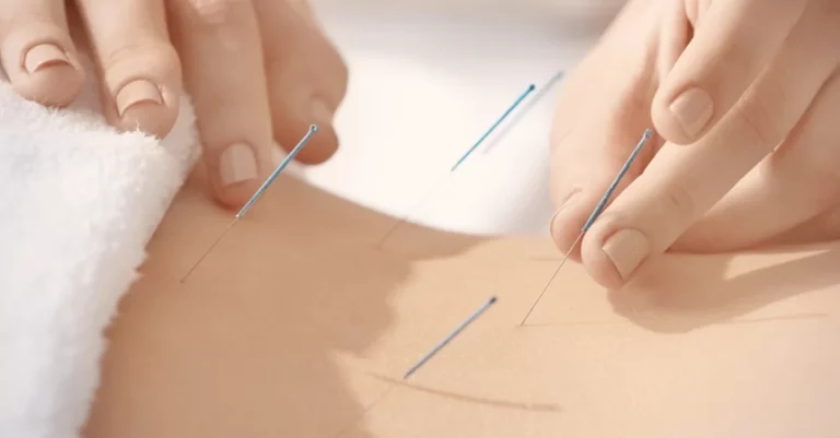 Akupunktur nedir? etkileri nelerdir?